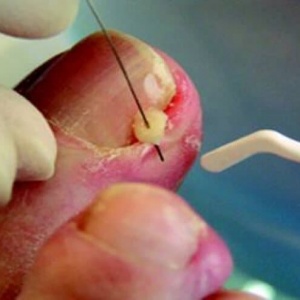 Cursus Fotopolymerisatie (Enkel training op afspraak.)